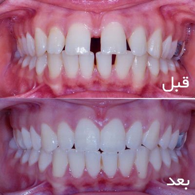 نمونه درمان ارتودنسی