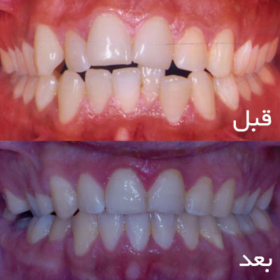 نمونه زیبایی دندان و صورت