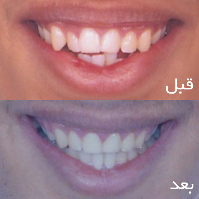 نمونه جراحی ارتودنسی